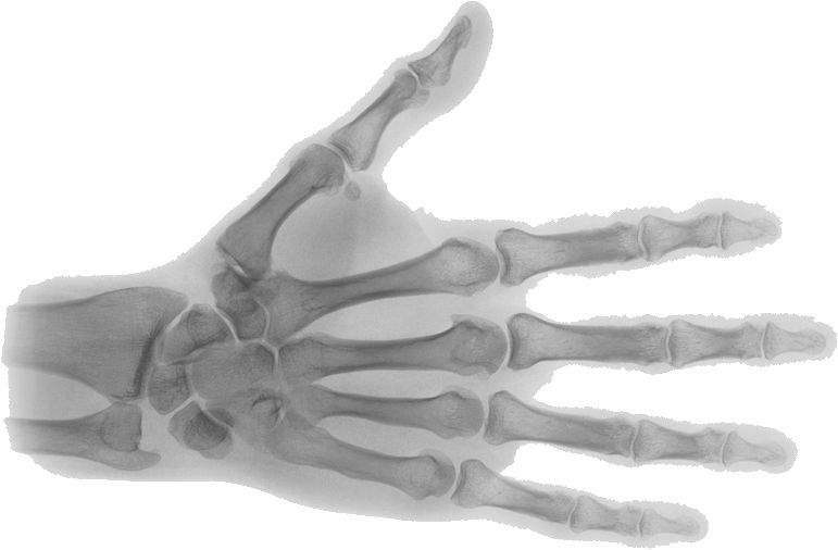 X-rays PNG    图片编号:96128
