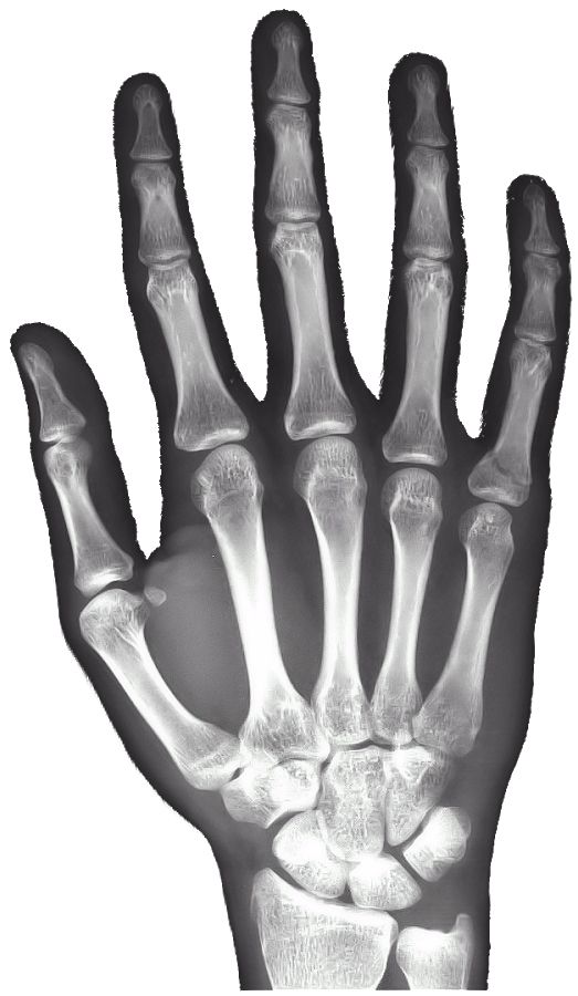 X-rays PNG    图片编号:96143