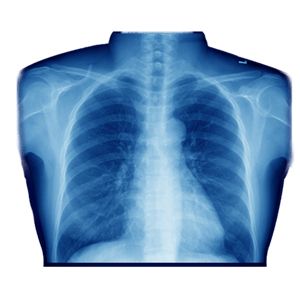 X-rays PNG    图片编号:96131