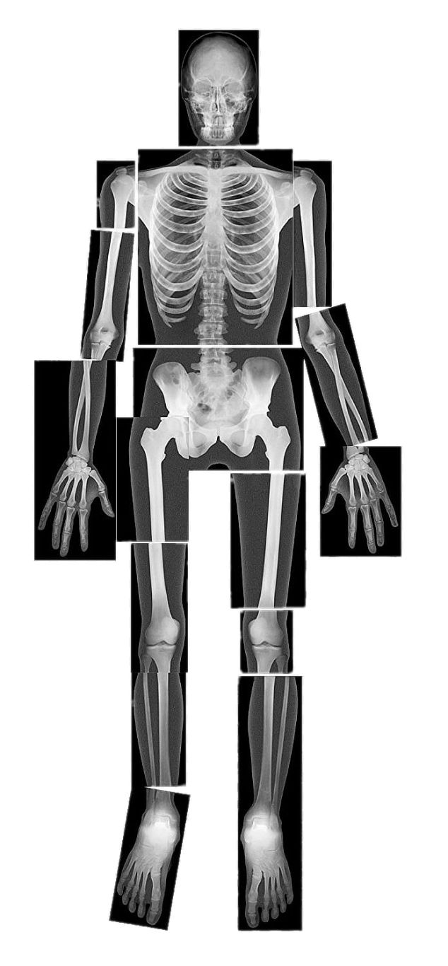 X-rays PNG    图片编号:96132