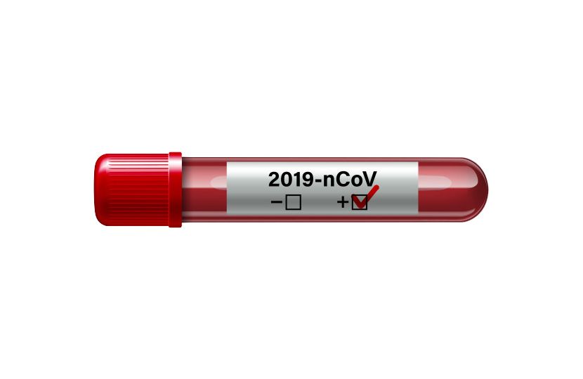 Coronavirus PNG    图片编号:93655