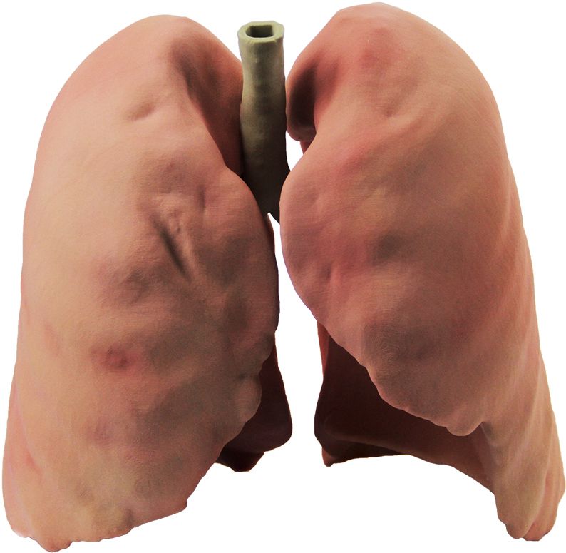 Lungs PNG    图片编号:74882
