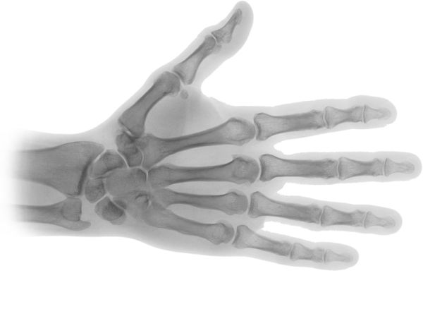 X射线PNG免抠图透明素材 16设计网